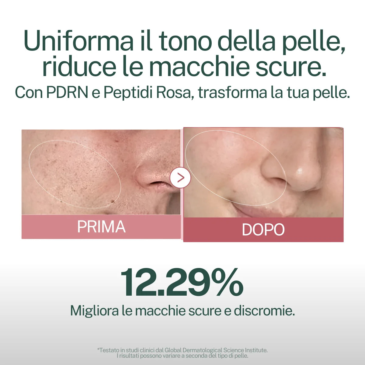 Tonico Rosa (con Peptidi e PDRN)