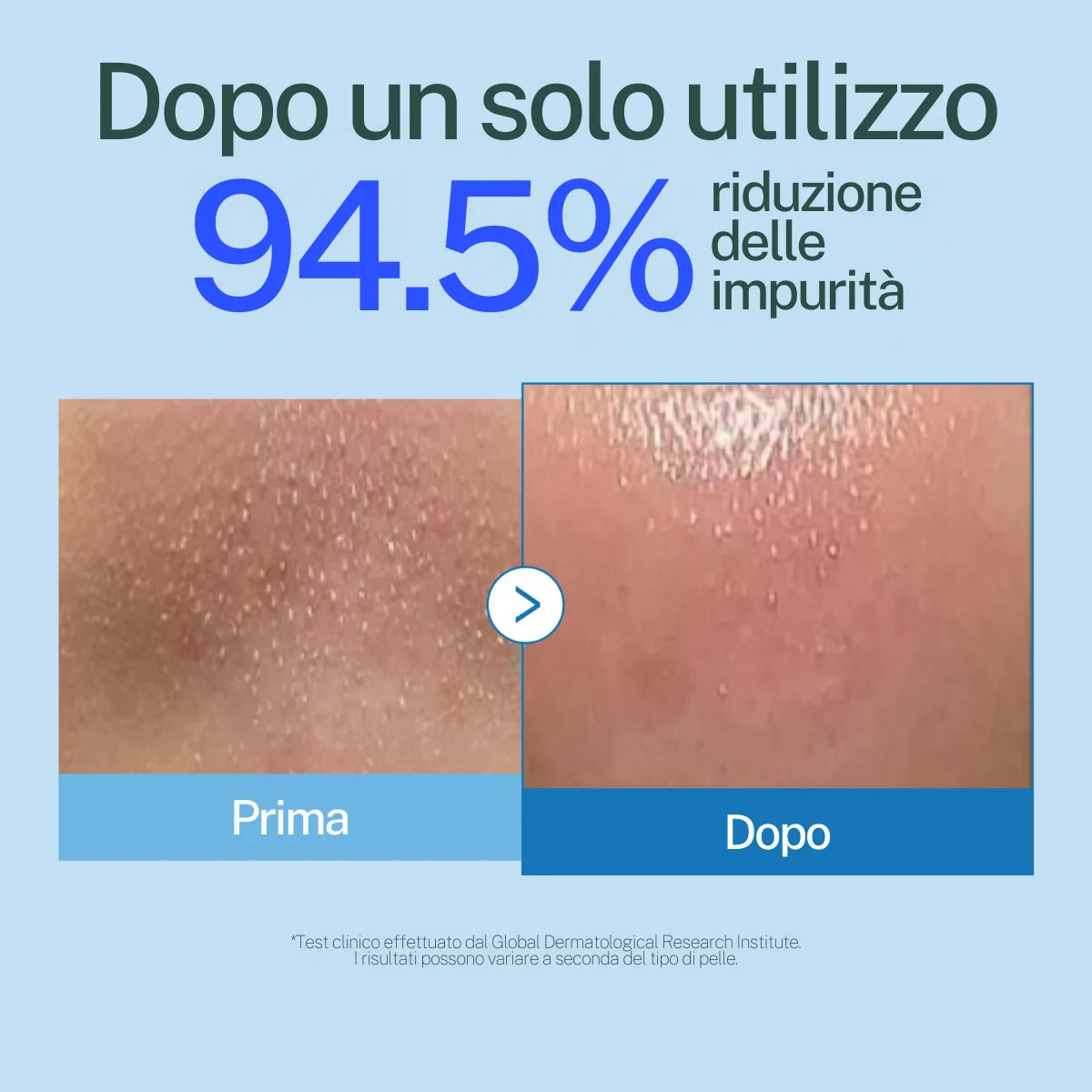 Detergente Oleoso "Zero Pori"