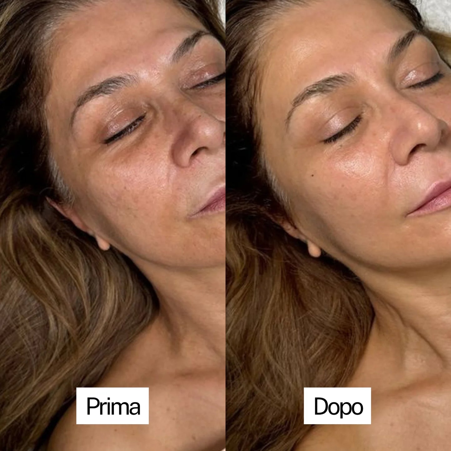 Skincare Completa | Il Kit