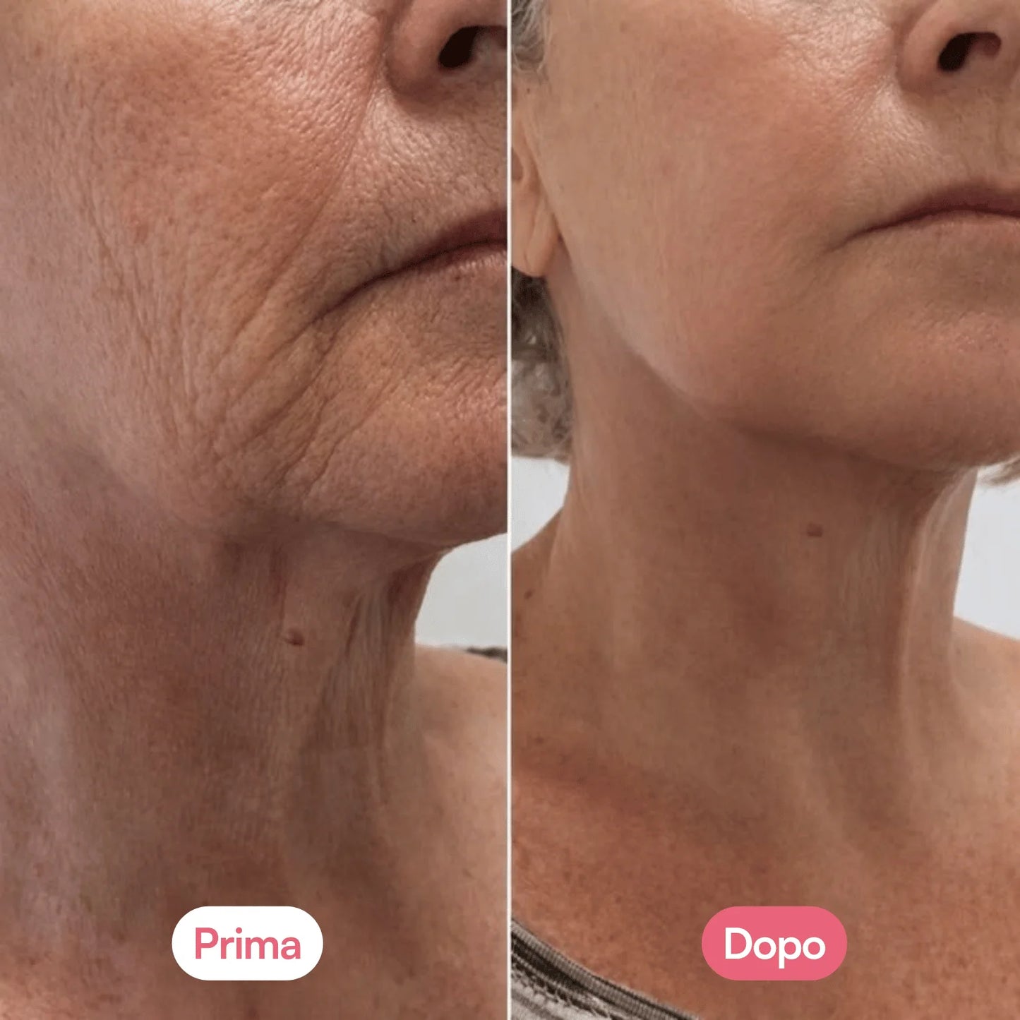 Crema Collo con PDRN e Massaggiatore Gua Sha