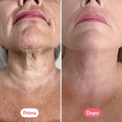 Crema Collo con PDRN e Massaggiatore Gua Sha