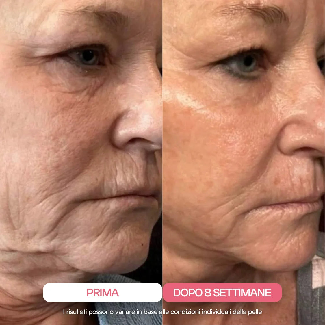 Maschera al Collagene Ultra-Assorbibile