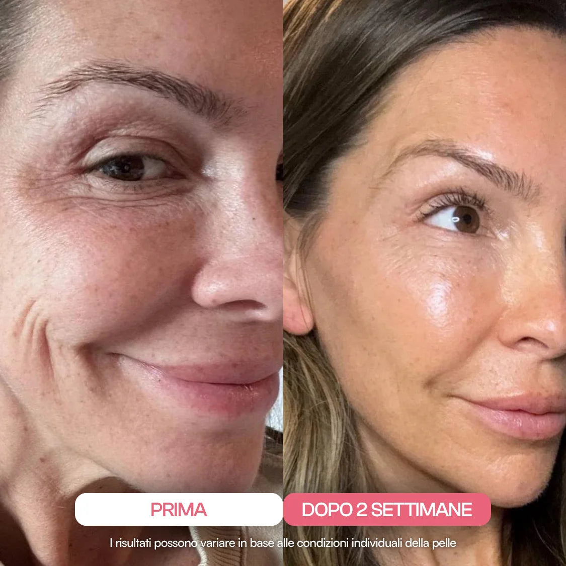 Maschera al Collagene Ultra-Assorbibile
