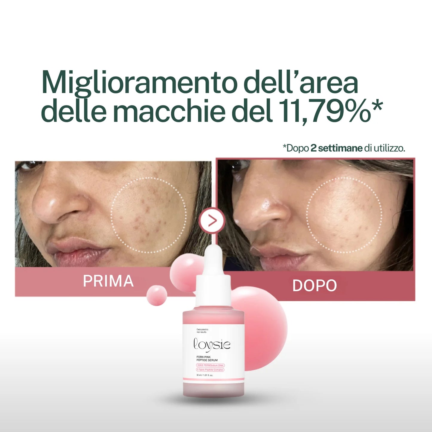"Addio cicatrici post-acne in 2 settimane" Kit Rigenerante