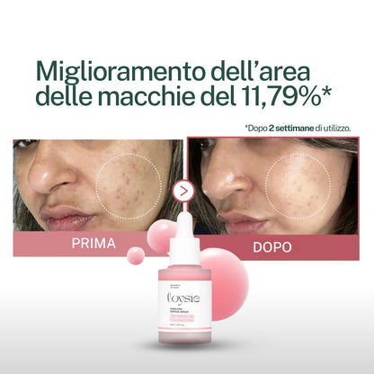 "Addio cicatrici post-acne in 2 settimane" Kit Rigenerante