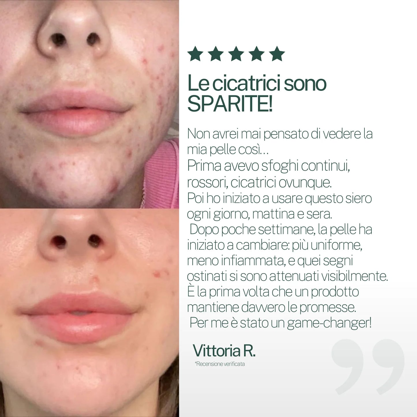 "Addio cicatrici post-acne in 2 settimane" Kit Rigenerante